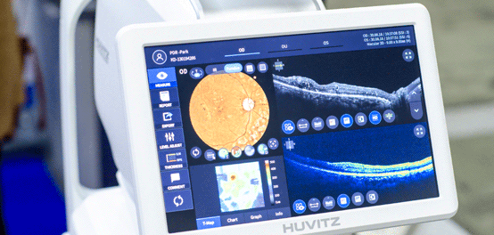 Optical Coherence Tomography