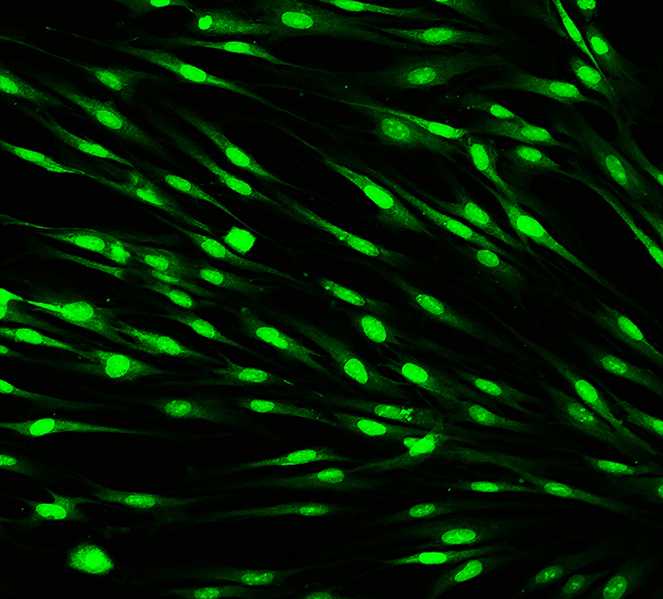 SpectralMD’s wound imaging system in use