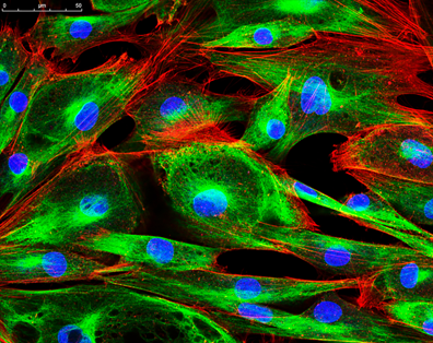 Figure 1: An image of protoplasts captured using confocal microscopy (left) that is more finely focused than an image of microspheres of a similar size captured using conventional epi-fluorescence microscopy.