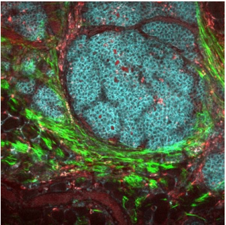Figure 3: An image of a mouse tumor captured using multiphoton microscopy, courtesy of the Laboratory for Optical and Computational Instrumentation (LOCI) at the University of Wisconsin, Madison.